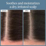 Briogeo Scalp Revival Rosemary Pre-Wash Oil - Moisturizing Scalp Treatment for Dry, Flaky, or Itchy Scalp, Strengthens Hair & Soothes Scalp, Vegan & Cruelty-Free, 3.4 oz - Image 3