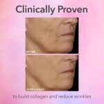 Dr. Dennis Gross DRx SpectraLite FaceWare Pro – LED Face Mask for Skin Rejuvenation with Dual Red & Blue Light Therapy, FSA HSA Eligible - Image 3