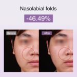 DermRays M1 4-in-1 Facial Toning Tool with Multi-Leading Tech for a Visibly Radiant & Youthful Appearance - Image 4