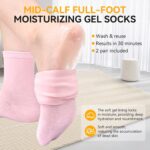 ESUOHYM Moisturizing Socks 2 Pairs Ankle Above Silicone Socks for Dry Cracked Feet One Size Pink and Beige- Self Care Gifts for Women - Image 5