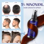 5% Minoxidil Hair Growth for Men and Women: Extra Strength Minoxidil Hair Loss Treatment Serum with Rosemary for Faster Stronger Thicker Hair Growth 60ML - Image 4