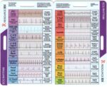 EKG Rhythm Interpretation - Compact & Portable Reference Card – Rapid Interpretation Guide – Dual Horizontal & Vertical Layout - Image 2