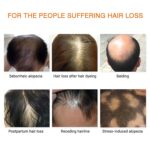 Hair Care Essential Oil Set - Hair Growth Shampoo & Hair Growth Essence Oil Containing Ginger Extract，Anti-Hair Loss Conditioner，Deep Nourish Repair ，Anti-Hair Loss & Anti-Frizz - Image 3