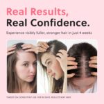 ForChics Hair Growth Serum for Women- Results in 4 Weeks- Hormone Free Hair Regrowth Treatment - For Thinning Hair Loss - Fast Absorbing Non-Greasy Scalp Spray 50ml - Image 4