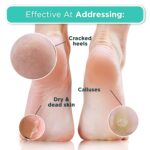 DERMORA Foot Peel Mask | Skin Exfoliating Foot Masks for Dry, Cracked Feet & Callus Removal | Dead Skin Exfoliator for Baby Soft Feet | Pack of 4 | Regular (Fits up to Men 10 / Women 11) | Original - Image 5