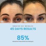 LED Face and Neck Massager – LiftLab 3-in-1 Beauty Sculptor with Red, Blue and Green Light Modes – at-Home Skincare Tool with Vibration Massage and Improved Battery - Image 5