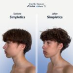 Simpletics Texturizing Powder - All Natural, 4 Ingredient Nourishing Formula with Rice Starch - Chemical Free - Gives Volumized, Texturized, Matte Finish to Men & Women - Image 3