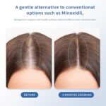 Hair Growth Serum Roll-On 30ml | Patented Blend with 3% Rosemary, 3% Redensyl, 2% AnaGain, Biotin & Niacinamide | No-Rinse, Fast-Absorbing | For Thinning Hair & All Hair Types (1.01 Fl Oz (Pack of 1)) - Image 3