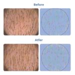 Hair Growth Serum Roll-On 30ml | Patented Blend with 3% Rosemary, 3% Redensyl, 2% AnaGain, Biotin & Niacinamide | No-Rinse, Fast-Absorbing | For Thinning Hair & All Hair Types (1.01 Fl Oz (Pack of 1)) - Image 5