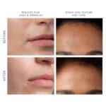 FOREO KIWI derma Microdermabrasion Machine Whitehead & Black Head Remover for Face - Skin Care Tools - Blackhead Extractor - No Pore Strips Suction - Vacuum Blackhead Remover - Image 6