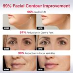 2-in-1 Red Light Microcurrent Facial Device | Enhances Lifting & Firming Capabilities | Reduces Wrinkles and Puffiness | Smart Photon Micro-Current Device, Model:EP-300 - Image 5