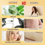 Facial Hair Removal For Women, Painless & Gentle Hair Removal Cream | Chin | Upper Lip | Cheeks for Sensitive Skin (5 Min, 7 Days) - 1.69Fl Oz - Image 5