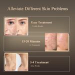 MEGELIN Led Red Light Therapy Face & Neck Mask, 7 Colors Led Light Therapy Facial Mask, Infrared Red Light Therapy Mask, Infrared Light Skin Rejuvenation(White) - Image 4