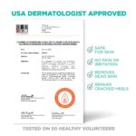 Lavinso Foot Peel Mask for Dry Cracked Feet – 2 Pack Peeling Mask Removes Dead Skin and Calluses - Exfoliating for Soft Baby Feet, Original Scent - Image 5