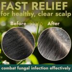 Tea Tree Scalp Scrub | Itchy & Dry Scalp Care with Tea Tree Oil, Quartz Powder & Sea Salt | Gently Exfoliates, Helps Reduce Flakes, Supports Healthy Hair Growth & Scalp Balance (pack of 2) - Image 6