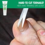 Toenail Softener for Thick Hard Toenails - Safe for Seniors & All Ages - Fast-Acting Toenail Softening Cream - Non Greasy Nail Cream Formulated with Natural Aloe Vera (1 Ounce Tube (Pack of 1)) - Image 3