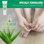 Toenail Softener for Thick Hard Toenails - Safe for Seniors & All Ages - Fast-Acting Toenail Softening Cream - Non Greasy Nail Cream Formulated with Natural Aloe Vera (1 Ounce Tube (Pack of 1)) - Image 4