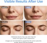 Skin Scrubber Face Spatula, Blackhead Remover Tool for Facial Deep Cleansing, Face Spatula Pore Cleaner with 4 Modes, Whitehead Remover, Blackhead Extractor, Face Scrubber (White) - Image 4