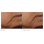 Dr Dennis Gross Advanced Retinol + Ferulic Intense Wrinkle Cream | Intensely Hydrating to Visibly Transform Skin and Repair the Moisture Barrier | 2 oz - Image 6