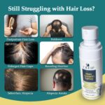 Natural Hair Growth Oil Spray: Natural Formula with Batana, Castor and Rosemary Oil, Rice Water, and Biotin for Women and Men - Image 4