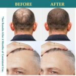 Natural Hair Growth Oil Spray: Natural Formula with Batana, Castor and Rosemary Oil, Rice Water, and Biotin for Women and Men - Image 5