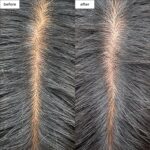 Briogeo Scalp Revival Charcoal + Tea Tree Cooling Hydration Scalp Mask | Weekly Scalp Treatment for Dry, Flaky, or Itchy Scalp | Detoxifying & Moisturizing | Vegan & Cruelty Free | 6 oz - Image 4